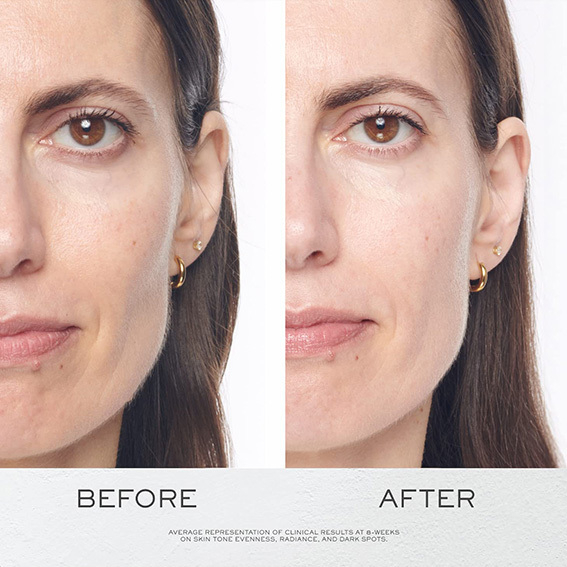 Rénergie H.C.F. Triple Serum - anti età 50 ml